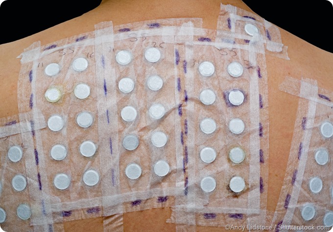 Allergy patch test